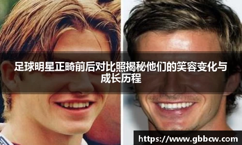 足球明星正畸前后对比照揭秘他们的笑容变化与成长历程